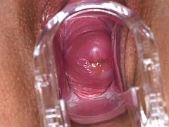 Fetisch, Gynäkologe, Masturbation, Solo