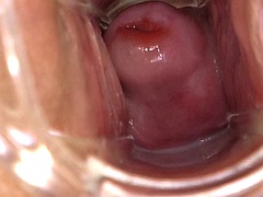 Orifice of the Euphrates