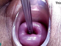 Asiatisch, Bizarr, Extrem, Gynäkologe, Masturbation, Milf, Solo, Spielzeuge