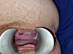 He used a speculum to open my vagina and a Pinpoint vibrator to massage my clitoris and penetrate my cervix